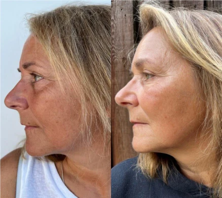 Customer result