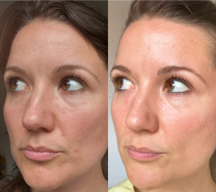 Customer result